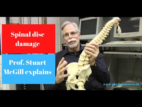 Back pain and disc injury – explained by Prof. Stuart McGill