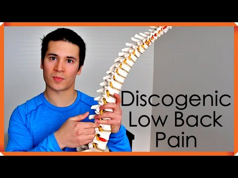 Diagnosis and Treatment of Discogenic Low Back Pain