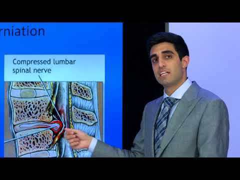 Diagnosis and Treatment of Lumbar Spine Conditions – Florida Orthopaedic Institute