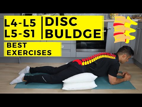 L4 L5 – L5 S1 disc bulge best exercise rehabilitation for pain relief