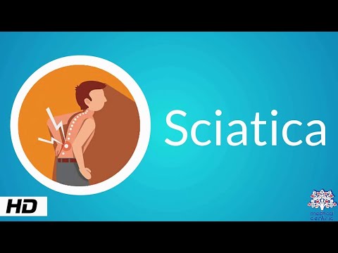 Sciatica, Causes, Signs and Symptoms, Diagnosis and Treatment