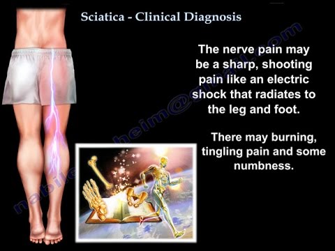 Sciatica Clinical Diagnosis – Everything You Need To Know – Dr. Nabil Ebraheim