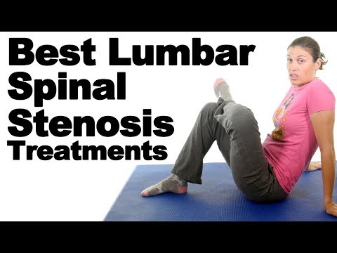 Top 5 Lumbar Spinal Stenosis Exercises & Stretches – Ask Doctor Jo